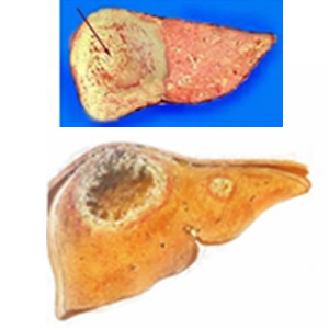 Amoebic Liver Abscess Model